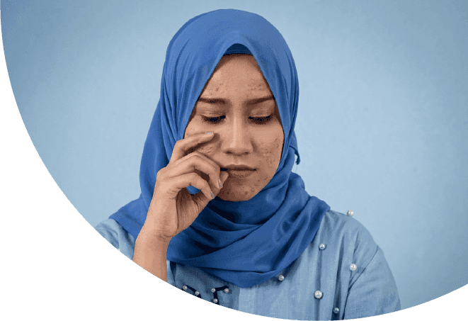 Cara Cepat Samarkan Dark Spot Saat Memasuki Usia 25 Tahun
