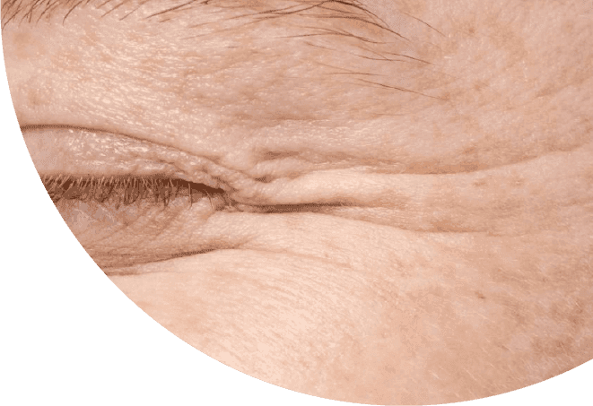 Wajah Kusam Saat Puasa? Jangan Salah, Ini Penyebab Utamanya